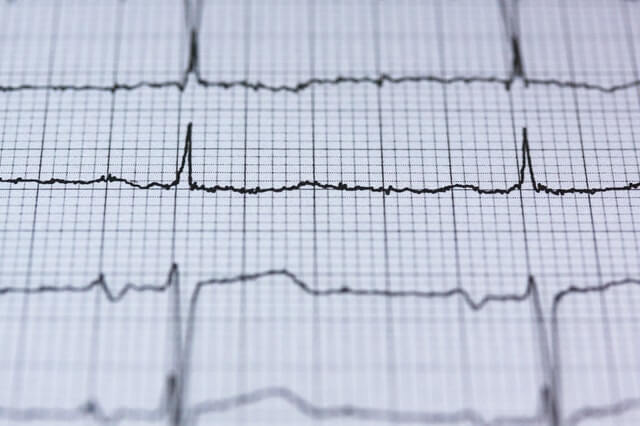 התקף לב בזמן עבודה נחשב לתאונת עבודה
